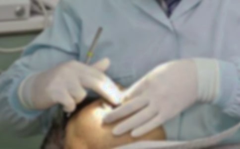 拔牙后注意事项智齿