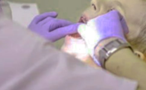 拔牙的注意事项介绍