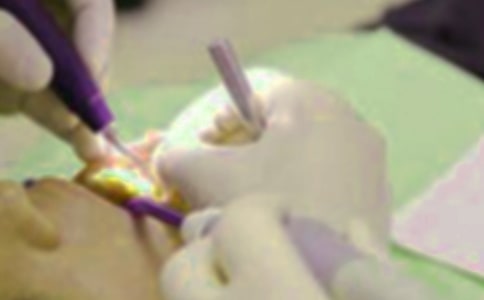 拔牙智齿后注意事项