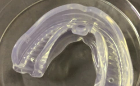 戴牙套的三大注意事项