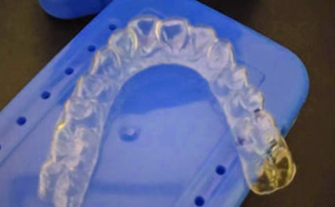 初戴牙套后的注意事项