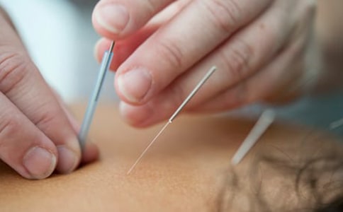 关于针灸减肥的注意事项