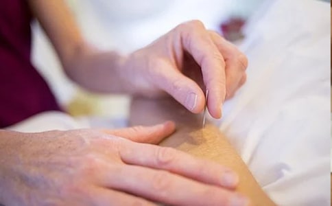 针灸科出科小结(通用18篇)