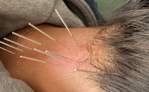 针灸推拿专业大学生自荐书范文