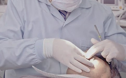 智齿拔后缝线注意事项